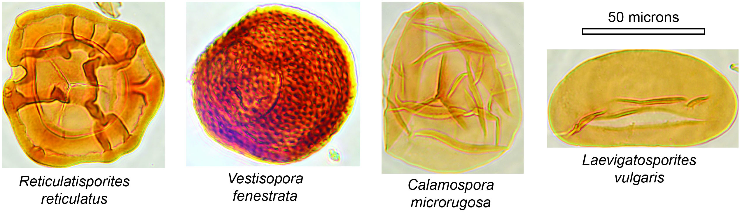 Microscopic spores of Calamites recovered from Kentucky coals.